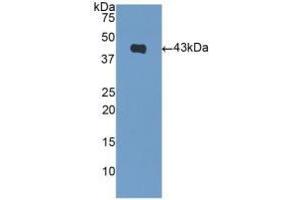 Detection of Recombinant NPPB, Mouse using Polyclonal Antibody to Natriuretic Peptide Precursor B (NPPB)