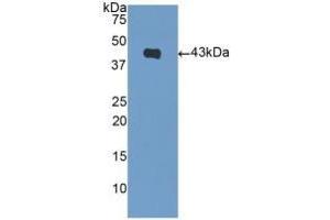 Detection of Recombinant NPPB, Mouse using Polyclonal Antibody to Natriuretic Peptide Precursor B (NPPB) (NPPB anticorps  (AA 27-121))