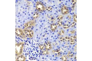 Immunohistochemistry of paraffin-embedded rat kidney using GIP antibody (ABIN5973668) at dilution of 1/100 (40x lens). (GIP anticorps)