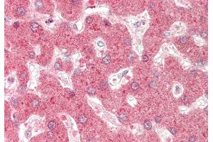 Rabbit Anti-DHODH antibody  Formalin Fixed Paraffin Embedded Tissue: Human Liver Primary antibody Concentration: 1:100 Secondary Antibody: Donkey anti-Rabbit-Cy3 Secondary Antibody Concentration: 1:200 Magnification: 20x Exposure Time: 0. (DHODH anticorps  (N-Term))