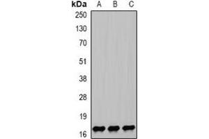 Western blot analysis of NPC2 expression in HEK293T (A), mouse lung (B), mouse liver (C) whole cell lysates. (NPC2 anticorps)