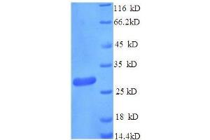 Cathepsin K (CTSK) (AA 115-329) protein (His tag) expressed in E.