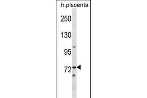 Mouse Sgk071 Antibody (N-term) (ABIN1539046 and ABIN2849427) western blot analysis in human placenta tissue lysates (35 μg/lane). (C9orf96 anticorps  (N-Term))