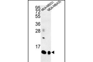 Western blot analysis of SPRR1B Antibody (C-term) (ABIN652994 and ABIN2842631) in MDA-M, MDA-M cell line lysates (35 μg/lane).
