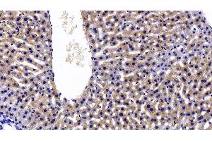 Detection of CRP in Mouse Liver Tissue using Polyclonal Antibody to C Reactive Protein (CRP) (CRP anticorps  (AA 17-224))