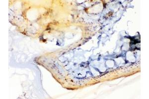 IHC testing of FFEP rat skin with Periplakin antibody at 1ug/ml.