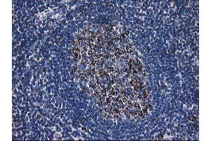 Image no. 5 for anti-Dihydrolipoamide Dehydrogenase (DLD) antibody (ABIN1497845) (DLD anticorps)