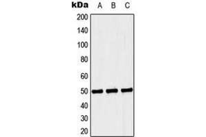 Western blot analysis of Septin 6 expression in Jurkat (A), NIH3T3 (B), PC12 (C) whole cell lysates. (Septin 6 anticorps  (Center))