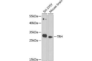 Western blot analysis of extracts of various cell lines, using TRH antibody (ABIN6130919, ABIN6149488, ABIN6149489 and ABIN6224343) at 1:1000 dilution.