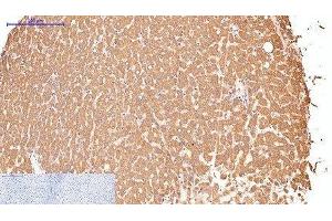 Immunohistochemistry of paraffin-embedded Human liver tissue using CD16 Monoclonal Antibody at dilution of 1:200. (CD16 anticorps)