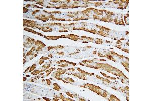 Anti-Cardiac FABP antibody, IHC(P) IHC(P): Rat Cardiac Muscle Tissue (FABP3 anticorps  (C-Term))
