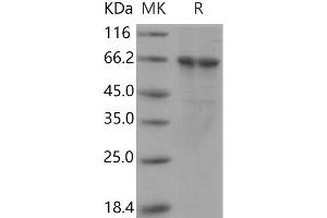 Western Blotting (WB) image for Polo-Like Kinase 1 (PLK1) (Active) protein (His tag) (ABIN7317096)