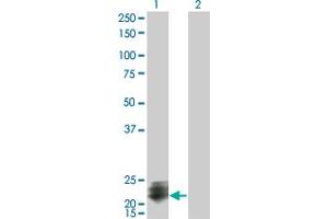 Western Blot analysis of STMN2 expression in transfected 293T cell line by STMN2 monoclonal antibody (M07), clone 2G7. (STMN2 anticorps  (AA 73-179))