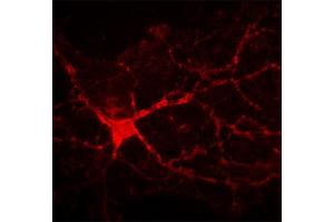 Indirect immunostaining of rat hippocampal neuron growing on astrocyte layer (dilution 1 : 200).