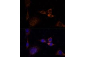 Immunofluorescence analysis of NIH/3T3 cells using PKCδ antibody (ABIN6128464, ABIN6146203, ABIN6146204 and ABIN6213859) at dilution of 1:100.
