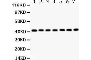 Anti- ACTIN antibody, Western blotting All lanes: Anti ACTIN  at 0. (Actin anticorps  (C-Term))