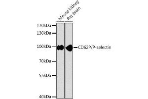 Western blot analysis of extracts of various cell lines, using CD62P/P-selectin antibody (ABIN6131513, ABIN6147502, ABIN6147505 and ABIN6216165) at 1:1000 dilution. (P-Selectin anticorps  (AA 220-319))