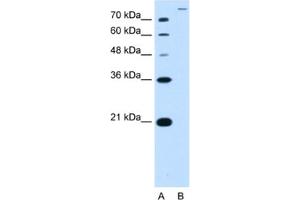 Western Blotting (WB) image for anti-Solute Carrier Family 26, Member 5 (Prestin) (SLC26A5) antibody (ABIN2462788) (SLC26A5 anticorps)
