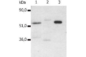 Immunoprecipitation of human CD4 from the lysate T cells isolated from fresh buffy coats. (CD4 anticorps)