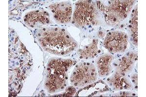 Immunohistochemistry (IHC) image for anti-Proteasome Subunit alpha 4 (PSMA4) antibody (ABIN1500459)