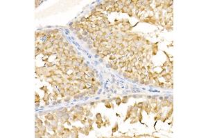 Immunohistochemistry of paraffin-embedded rat testis using KIF3A Rabbit pAb (ABIN6128170, ABIN6142871, ABIN6142872 and ABIN6222335) at dilution of 1:500 (40x lens). (KIF3A anticorps  (AA 430-699))