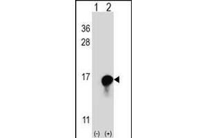 Western blot analysis of FKBP1A (arrow) using rabbit polyclonal FKBP1A Antibody (C-term) (ABIN1882082 and ABIN2841885). (FKBP1A anticorps  (C-Term))