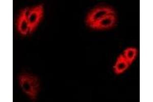 Immunofluorescent analysis of IRBP staining in MCF7 cells. (RBP3 anticorps)