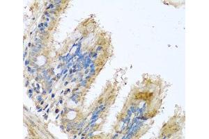 Immunohistochemistry of paraffin-embedded Human trachea using COX6B1 Polyclonal Antibody at dilution of 1:100 (40x lens). (COX6B1 anticorps)