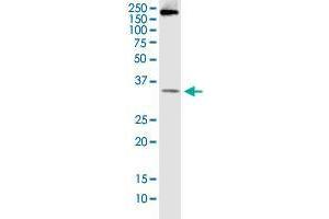 BCL7B monoclonal antibody (M01), clone 6D2.