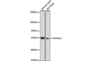 Western blot analysis of extracts of various cell lines, using TINAGL1 antibody (ABIN6293721) at 1:3000 dilution. (TINAGL1 anticorps)