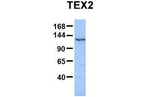 Host:  Rabbit  Target Name:  TEX2  Sample Type:  Human HepG2  Antibody Dilution:  1. (TEX2 anticorps  (N-Term))