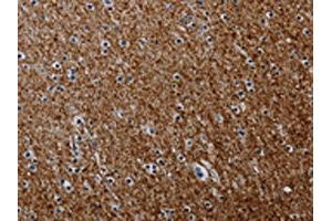 The image on the left is immunohistochemistry of paraffin-embedded Human brain tissue using ABIN7191804(PCDHAC1 Antibody) at dilution 1/50, on the right is treated with synthetic peptide. (PCDHAC1 anticorps)