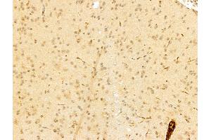 ABIN7094250 and ABIN7098297 at 1/100 staining Mouse brain tissue by IHC-P. (GAS7 anticorps  (Internal Region))
