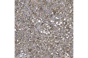 IHC analysis of SEMA4F using anti-SEMA4F antibody (ABIN7601432).