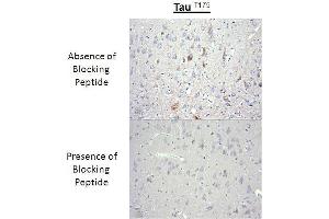 Immunohistochemistry analysis of a competition assay demonstrating the specificity of the anti-Tau (Thr-175) antibody