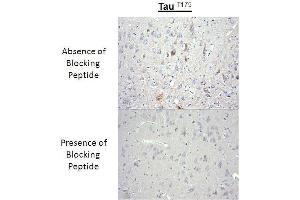 Immunohistochemistry analysis of a competition assay demonstrating the specificity of the anti-Tau (Thr-175) antibody (tau anticorps  (pThr175))