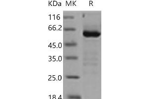 Western Blotting (WB) image for 5'-Nucleotidase, Ecto (CD73) (NT5E) (Active) protein (His tag) (ABIN7194081) (CD73 Protein (His tag))