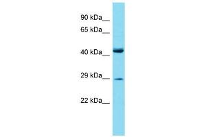 Host:  Rabbit  Target Name:  Prrx2  Sample Type:  Mouse Small Intestine lysates  Antibody Dilution:  1. (PRRX2 anticorps  (Middle Region))