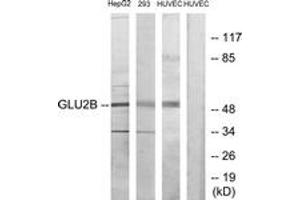 Western blot analysis of extracts from HepG2/293/HuvEC cells, using GLU2B Antibody. (PRKCSH anticorps  (AA 81-130))