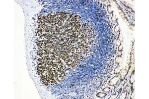 IHC-P: MCM2 antibody testing of rat intestinal lymphocyte tissue