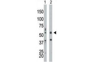 PKR antibody used in western blot to detect PRKR/PKR in mouse liver tissue lysate (Lane 1) and HepG2 cell lysate (2). (EIF2AK2 anticorps  (AA 11-42))