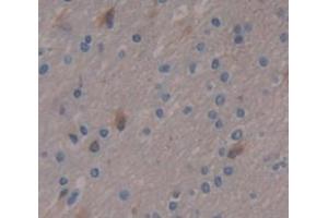 IHC-P analysis of Human Tissue, with DAB staining. (PPL anticorps  (AA 1439-1716))