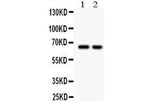 Lane 2: COLO320 Whole Cell Lysate at 40ug Predicted bind size: 65KD Observed bind size: 65KD (TGFBR2 anticorps  (Middle Region))