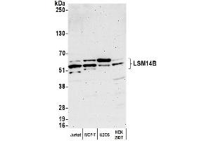 Western Blotting (WB) image for anti-LSM14B, SCD6 Homolog B (LSM14B) (AA 335-385) antibody (ABIN7452573)