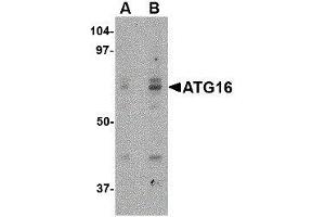 Western Blotting (WB) image for anti-ATG16 Autophagy Related 16-Like 1 (ATG16L1) (Internal Region) antibody (ABIN2477528) (ATG16L1 anticorps  (Internal Region))