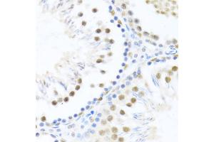 Immunohistochemistry of paraffin-embedded rat testis using DDX46 antibody  at dilution of 1:100 (40x lens). (DDX46 anticorps  (AA 682-1031))