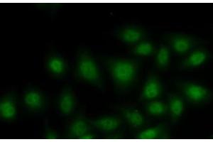 Immunofluorescence analysis of MCF7 cells using RORA Polyclonal Antibody (RORA anticorps)