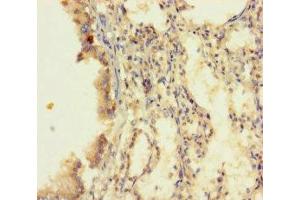 Immunohistochemistry of paraffin-embedded human lung tissue using ABIN7173528 at dilution of 1:100 (DUS4L anticorps  (AA 1-196))