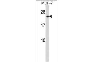 Western blot analysis in MCF-7 cell line lysates (35ug/lane). (CHMP1A anticorps  (N-Term))