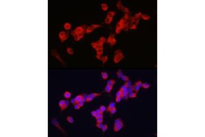 Immunofluorescence analysis of SH-SY5Y cells using KIF5A Rabbit pAb (ABIN1680589, ABIN3017664, ABIN3017665 and ABIN6220202) at dilution of 1:250 (40x lens). (KIF5A anticorps  (AA 933-1032))